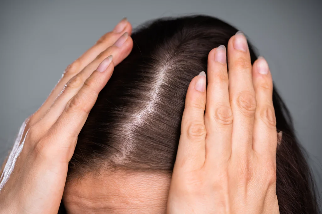 Professional Hair Bleach Products Compared Schwarzkopf, Wella, L’Oreal and Fanola